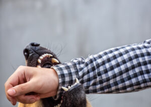Why Choose J. Hartley Law Personal Injury Lawyers For Help After a Dog Attack in El Segundo, CA